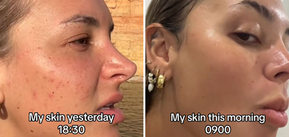 کرم محافظ و ضد اگزمای سودوکرم با ترکیبات زینک اکساید و لانولین برای پوست حساس