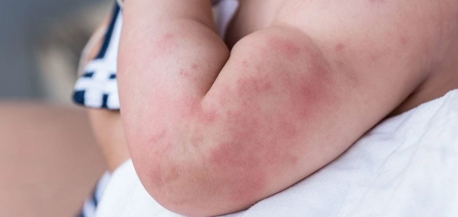 محافظت از پوست نوزاد در برابر تحریکات و حساسیت با کرم سودوکرم اصل در زیبارو-آنلاین