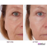 سرم پوست ORDINARY اوردینری مدل HYALURONIC ACID