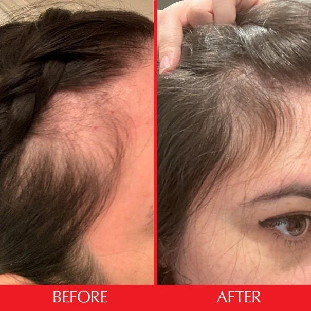 کپسول هیرتامین برای چی خوبه