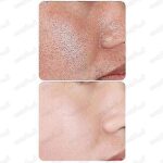 ماسک ورقی صورت VEZEویزی مدلSALICYLIC ACIDاسید سالیسیلیک