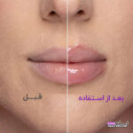 حجم دهنده لب SHEGLAMشیگلم مدلOH EM GEE-HOT GOSS LIP GLOSS
