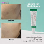 سرم پوست AXIS-Y اکسس-وای مدل DARK SPOT CORRECTING GLOW