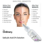 سرم پوست ORDINARY اوردینری مدل SALICYLIC ACID