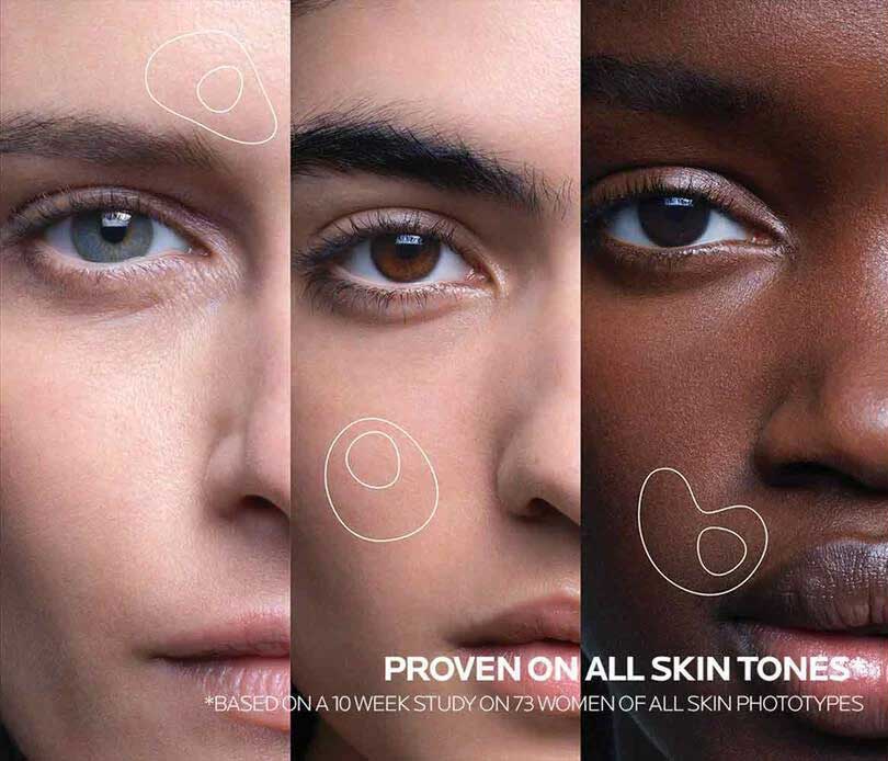 لاروش پوزای