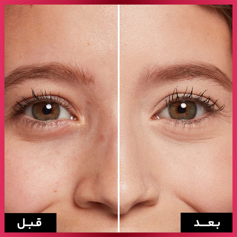 مزایای کانسیلر لورال