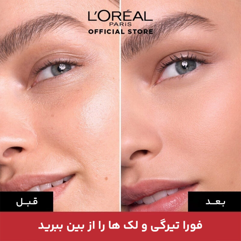 کانسیلر لورال