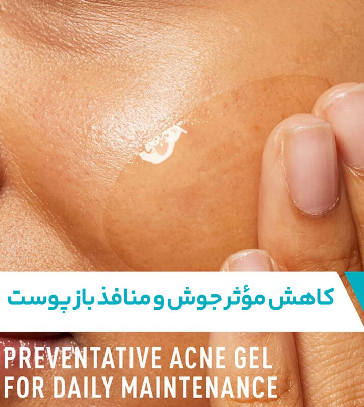 ژل ضد جوش سراوی