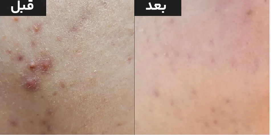 سرم ریدل شات اصل