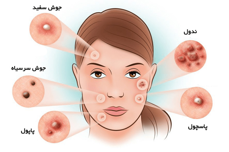 جدول انواع جوش