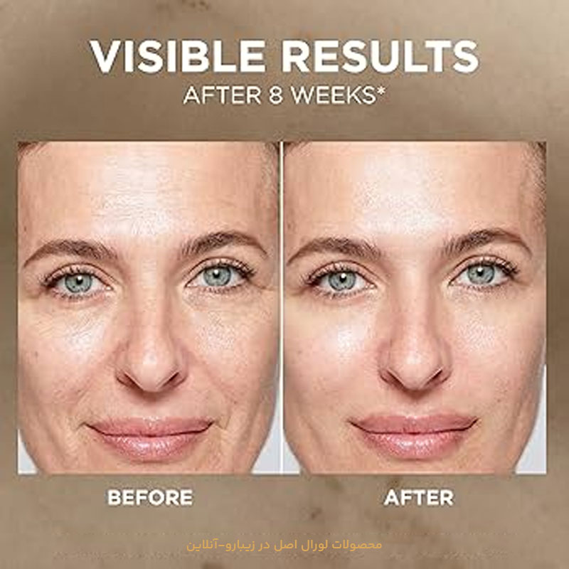 نتایج قبل و بعد از استفاده از کرم دور چشم لورال