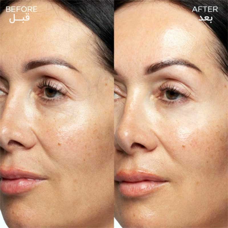 استفاده از کرم کلاژن بانک کلامین روی پوست صورت