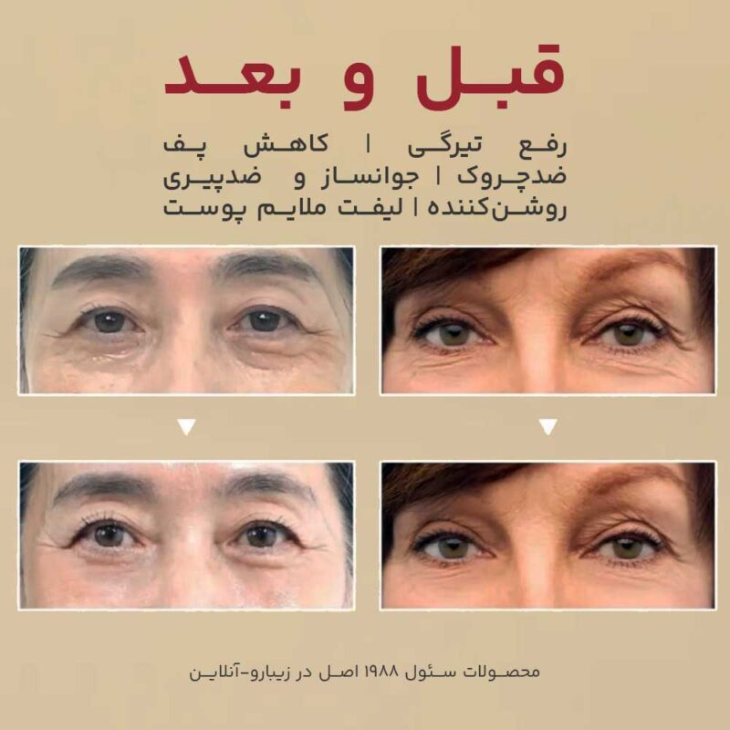 قیمت کرم دور چشم سئول ۱۹۸۸