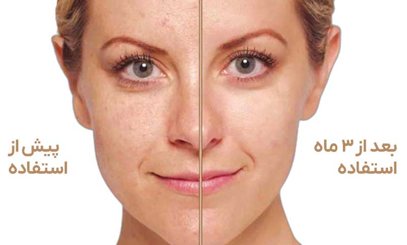 سرم رتینول ویتالیر برای چیست