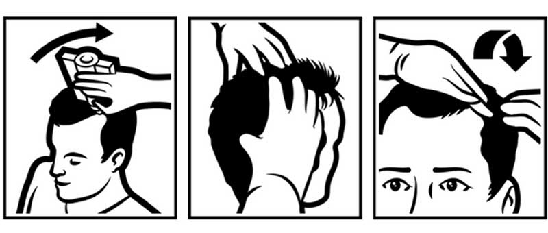 تونیک ضد ریزش آلپسین