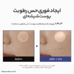 قبل و بعد استفاده از میست ژله ای آبرسان دکتر آلتیا با بهبود بافت و شفافیت پوست