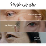 کرم تیرگی دور چشم ملاکسین برای گودی، تیرگی، پف و خطوط ریز اطراف چشم