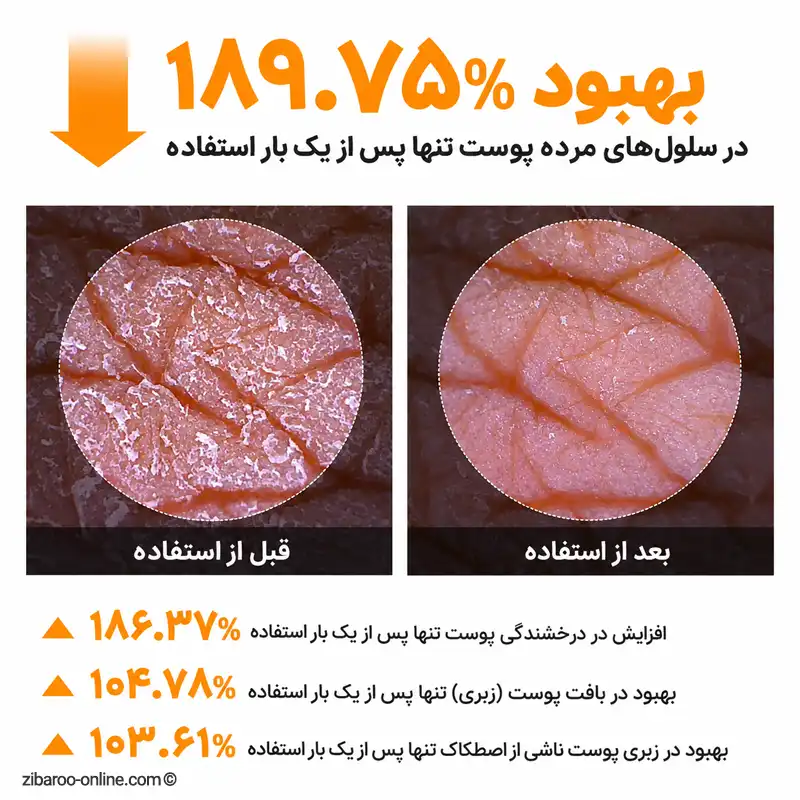 نتایج بالینی اسپری پیل شات دکتر ملاکسین