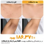 خواص روشن کنندگی اسپری کوجیک اسید دکتر ملاکسین