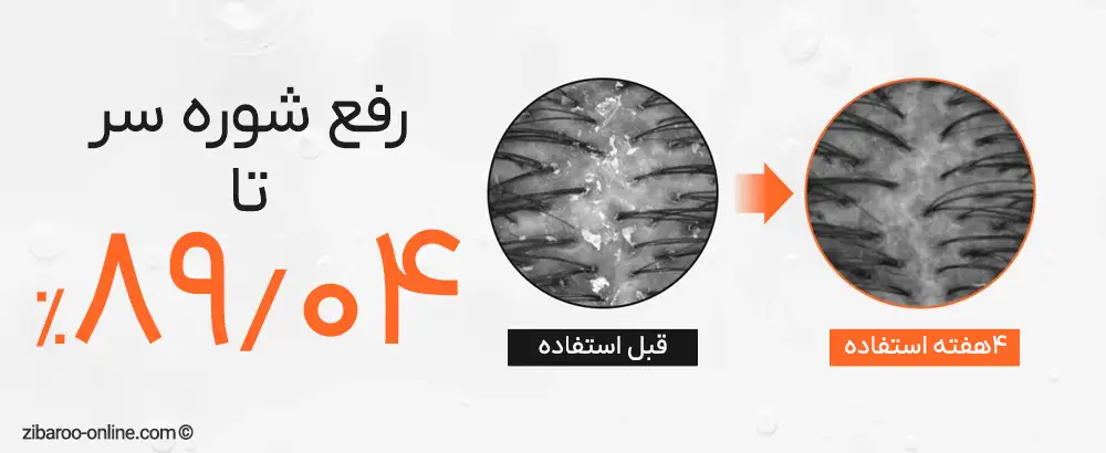 رفع شوره سر با سرم آمپول براش لیلوئه LILYEVE Growturn Exosome Brush Ampoule 100ml