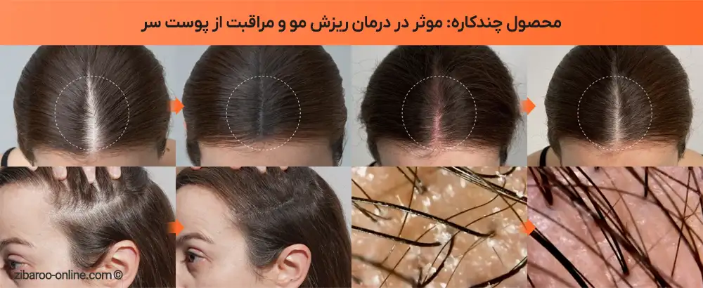 نتایج قبل و بعد استفاده از سرم مو LILYEVE Growturn