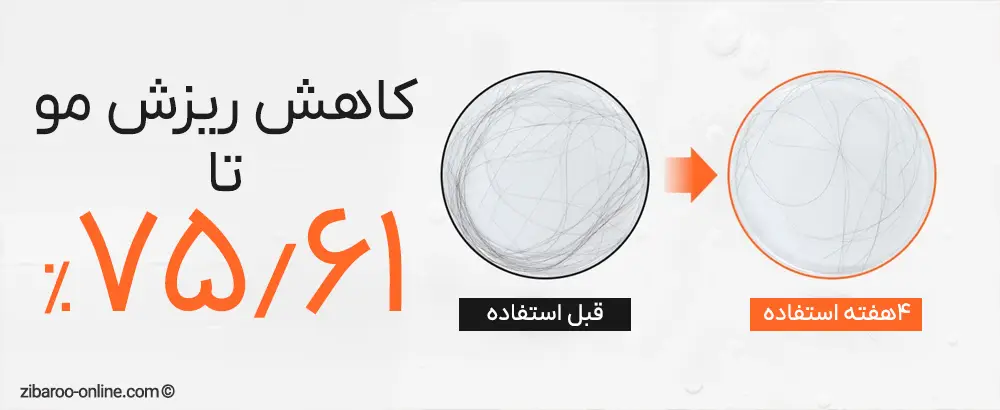بررسی کاهش ریزش مو و شوره کف سر با Lilyeve Growturn