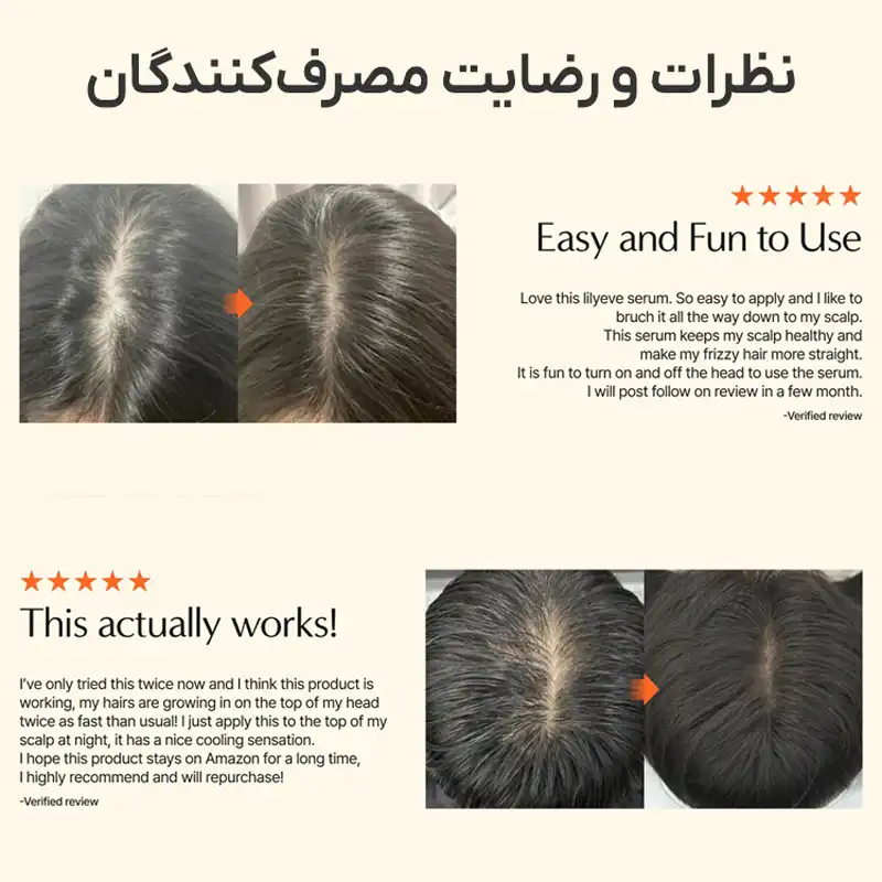 رضایت کاربران از سرم مو لیلیوئه