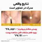 نتایج آزمون بالینی پیل شات مدیکیوب در بهبود درخشندگی و صافی پوست پس از دو هفته
