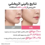 نتایج ارزیابی بالینی کرم گواشا گردن مدیکیوب برای ظاهر چروک، پف و آبرسانی